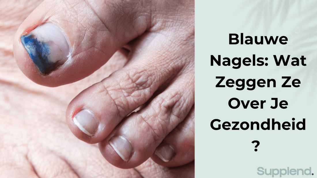 Blauwe Nagels: Wat Zeggen Ze Over Je Gezondheid?