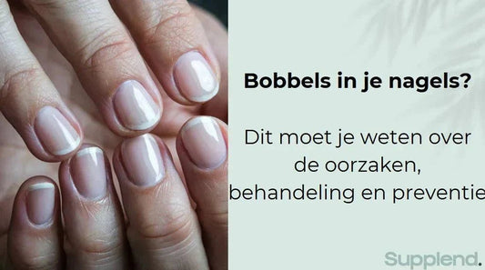 Bobbels in je nagels? Dit moet je weten over de oorzaken, behandeling en preventie