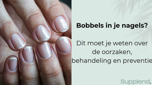 Bobbels in je nagels? Dit moet je weten over de oorzaken, behandeling en preventie