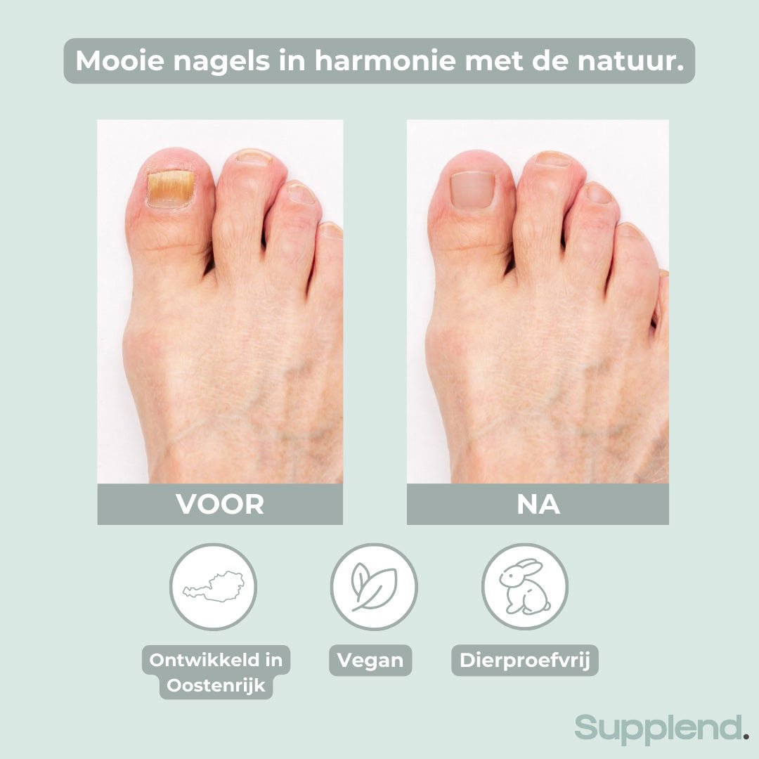 Nagelverzorgingspen (Nieuwe PDP)